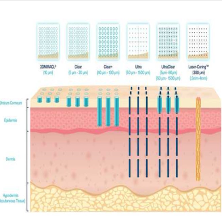 울트라클리어 세부 모드별 작용 깊이 도식 - 3D MIRACL, Clear, Clear+, Ultra, UltraClear, Laser-Coring